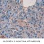 Dystrobrevin Beta (DTNb) Antibody