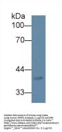 Dipeptidase 2 (DPEP2) Antibody