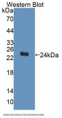 Dipeptidase 2 (DPEP2) Antibody