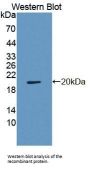Regulator of G Protein Signaling 7 (RGS7) Antibody