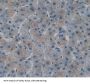 T-Cell Lymphoma Invasion And Metastasis Inducing Protein 1 (TIAM1) Antibody