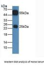Immunoglobulin G (IgG) Antibody