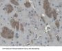 2, 3 Cyclic Nucleotide 3 Phosphohydrolase (CNP) Antibody