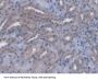 Lactosylceramide 4-Alpha-Galactosyltransferase (A4GALT) Antibody