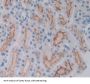 Lactosylceramide 4-Alpha-Galactosyltransferase (A4GALT) Antibody