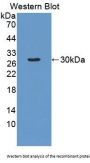 Antigen Peptide Transporter 2 (TAP2) Antibody