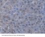 Antigen Peptide Transporter 2 (TAP2) Antibody