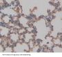 Antigen Peptide Transporter 2 (TAP2) Antibody