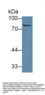 ATP Binding Cassette Subfamily B Member 10 (ABCB10) Antibody