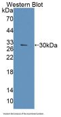 ATP Binding Cassette Transporter B8 (ABCB8) Antibody