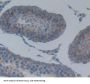 ATP Binding Cassette Transporter B8 (ABCB8) Antibody