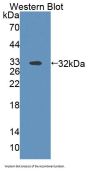 ATP Binding Cassette Transporter B9 (ABCB9) Antibody