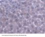 ATP Binding Cassette Transporter B9 (ABCB9) Antibody