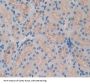 ATP Binding Cassette Transporter B9 (ABCB9) Antibody