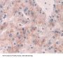 ATP Binding Cassette Subfamily G Member 4 (ABCG4) Antibody