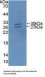 ATP Binding Cassette Subfamily G Member 5 (ABCG5) Antibody