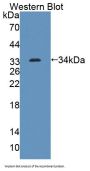 ATP Binding Cassette Subfamily G Member 8 (ABCG8) Antibody