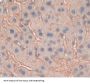 ATP Binding Cassette Subfamily G Member 8 (ABCG8) Antibody