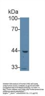 Acetyl Coenzyme A Acyltransferase 1 (ACAA1) Antibody