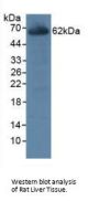 Carboxylesterase 1 (CES1) Antibody