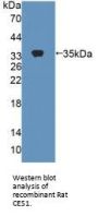 Carboxylesterase 1 (CES1) Antibody