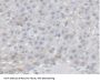 Carboxylesterase 1 (CES1) Antibody