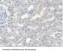 Carboxylesterase 1 (CES1) Antibody