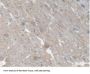 Carboxylesterase 1 (CES1) Antibody
