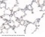 Carboxylesterase 1 (CES1) Antibody