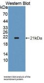 Peroxisomal D3, D2-Enoyl Coenzyme A Isomerase (PECI) Antibody