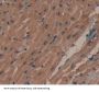 Peroxisomal D3, D2-Enoyl Coenzyme A Isomerase (PECI) Antibody