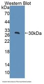 Acetyl Coenzyme A Carboxylase Beta (ACACb) Antibody