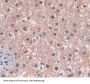 Acetyl Coenzyme A Carboxylase Beta (ACACb) Antibody