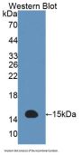 Acylphosphatase 2, Muscle (ACYP2) Antibody