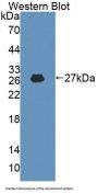 Alpha Adducin (ADD1) Antibody