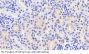 Alpha Adducin (ADD1) Antibody
