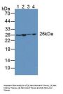 Adenylate Kinase 2 (AK2) Antibody