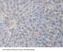 Alanine Glyoxylate Aminotransferase (AGXT) Antibody