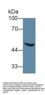 Alanine Glyoxylate Aminotransferase 2 (AGXT2) Antibody