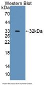 Alanine Glyoxylate Aminotransferase 2 (AGXT2) Antibody