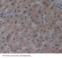 Alanine Glyoxylate Aminotransferase 2 (AGXT2) Antibody
