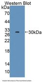 Actinin Alpha 1 (ACTN1) Antibody