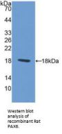 Paired Box Gene 6 (PAX6) Antibody