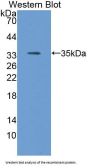 Apolipoprotein C2 (APOC2) Antibody