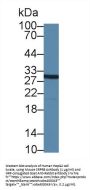 Signal Recognition Particle Receptor B (SRPRB) Antibody