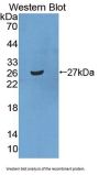 Signal Recognition Particle Receptor B (SRPRB) Antibody