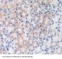Signal Recognition Particle Receptor B (SRPRB) Antibody