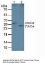 Lysophospholipase II (LYPLA2) Antibody