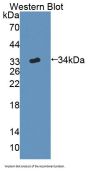 Chimerin 2 (CHN2) Antibody