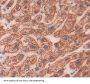 Chimerin 2 (CHN2) Antibody